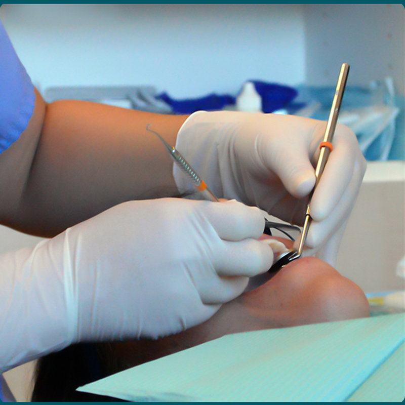 Găng Tay Latex Examination Gloves Có Bột Làm Từ Cao Su Thiên Nhiên - Loại Sử Dụng 1 Lần