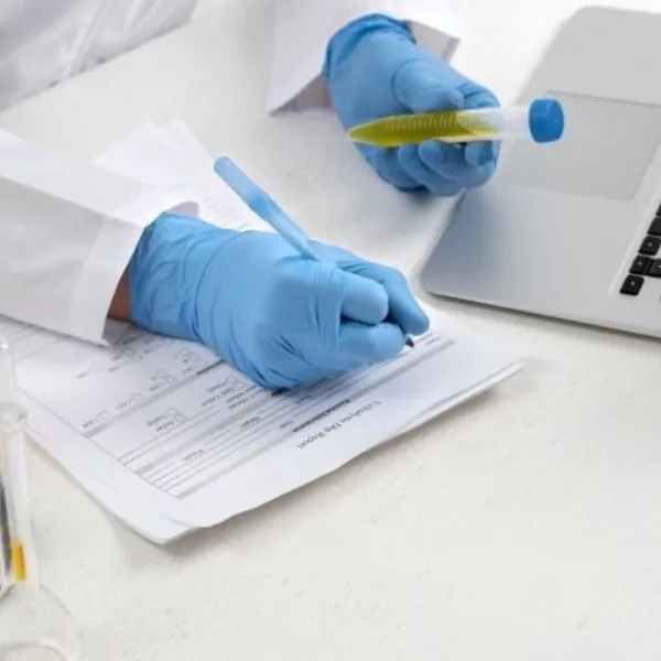 Găng Tay Y Tế Nitrile SSGlove